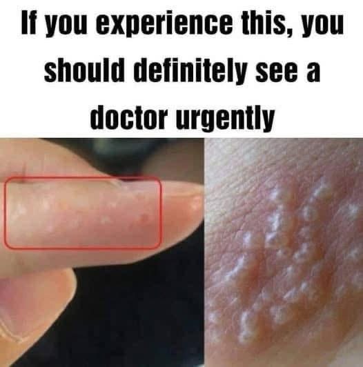 Ií you experience this, you should definitely see a doctor urgently