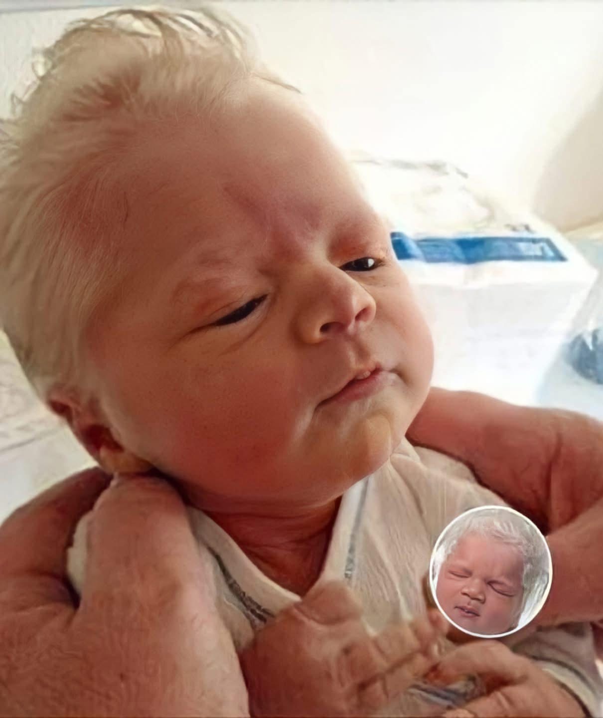 Albino baby mocked for white hair is happy and healthy years later