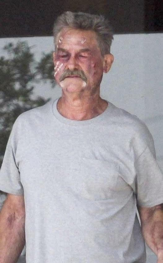 Please pray for Kurt Russell. What happened to him is horrific.