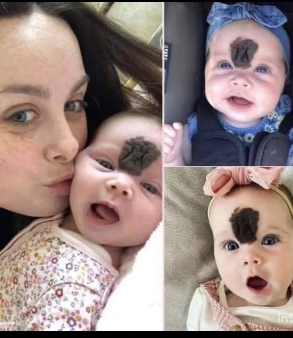 PARENTS KEPT THEIR BABY HIDDEN TO SHIELD HER FROM PEOPLE’S CURIOUS LOOKS. NOW, AT THE AGE OF 2, SHE LOOKS BEAUTIFUL.