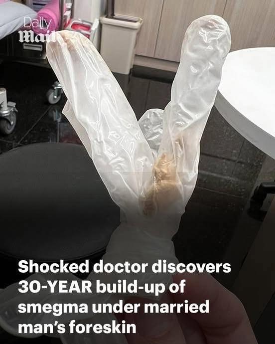 Shocked doctor discovers 30-YEAR build-up of smegma under the foreskin of married man who was suffering agonising pain in his penis