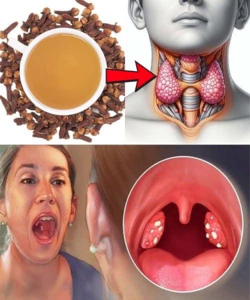 Got A Sore Throat? Try This Tiny Spice That Works Like Nature’s Antibiotic