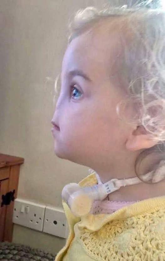 Tessa Evans’ Rare Condition: Overcoming Challenges