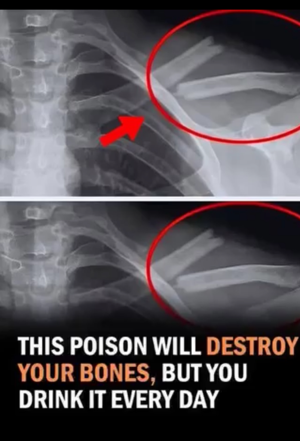 Ditching Diet Soda? Here’s What Really Happens to Your Body
