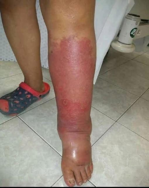Health Warning Signs On Your Feet You Should Never Ignore