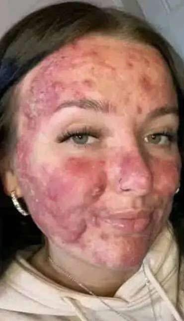 His body was itchy, he thought it was an allergy, they diagnosed him with ca…see more
